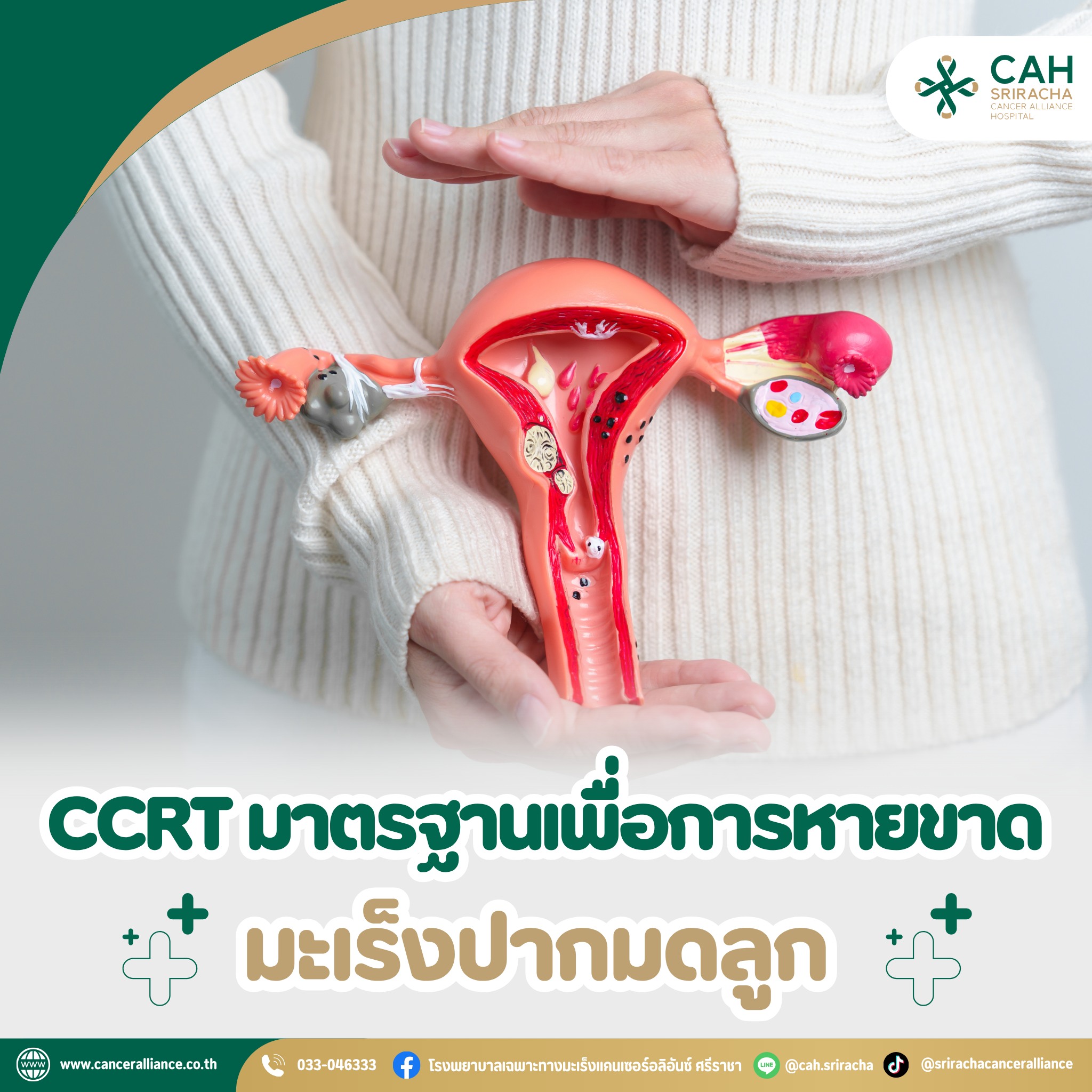 CCRTมะเร็งปากมดลูก - โรงพยาบาลเฉพาะทางมะเร็งแคนเซอร์อลิอันซ์ ศรีราชา